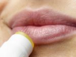 Hilft CBD gegen (Lippen) Herpes