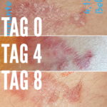 Malantis - CBD SkinBalm Hauttest